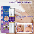 Mole & Wart Removal Gel Pen