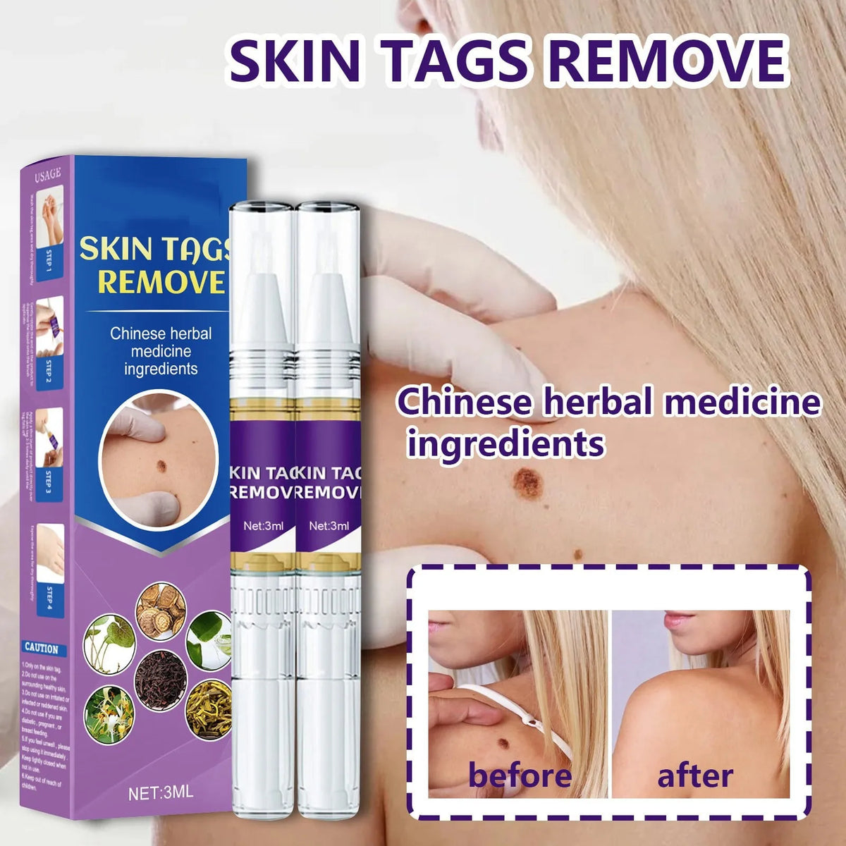 Mole & Wart Removal Gel Pen