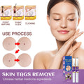 Mole & Wart Removal Gel Pen